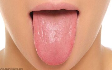 بیماری‌های زبان و انواع رایج آن را بشناسید/ زبان در مورد سلامتی چه می‌گوید؟