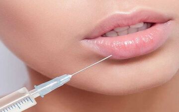 فیلر لب؛ چه چیزهایی را قبل از تزریق فیلر باید بدانید؟
