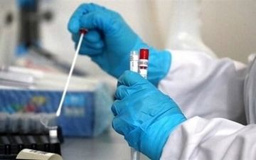 اعلام فهرست آزمایشگاه‌های تشخیص کووید ۱۹ 