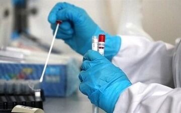 اعلام فهرست آزمایشگاه‌های تشخیص کووید ۱۹ 