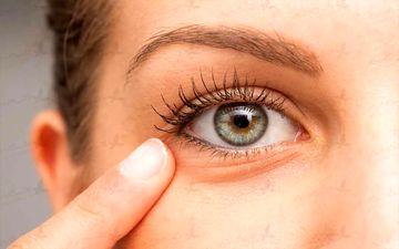 مواد طبیعی و گیاهی برای جلوگیری از چروک دور چشم