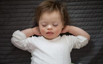 تشخیص زودهنگام سندرم داون / تشخیص و مداخله زودهنگام در سندرم داون