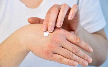  بررسی نقش طب سنتی در درمان‌ بیماری‌‌های پوستی

