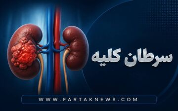 ۵ علامت مهم سرطان کلیه که باید جدی بگیرید