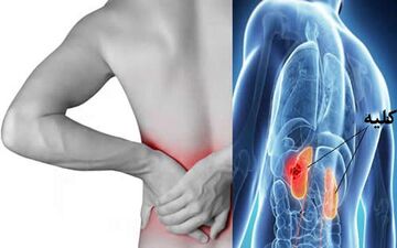 خداحافظی با یک نوع سرطان شایع

