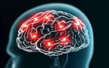 مه مغزی را با بروفن درمان کنید!