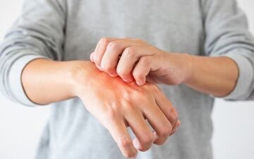 ۶ راز طلایی برای داشتن پوستی نرم و لطیف| جلوگیری از خشکی پوست با راهکارهای ساده