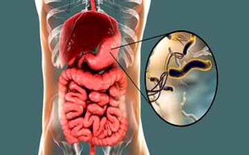 راه‌های تشخیص و انتقال میکروب معده 
