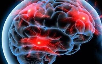 دستاورد هسته‌ای ایران؛ رادیوداروی ایرانی آلزایمر را ۲۰ سال زودتر شناسایی می‌کند