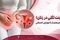 عفونت لگنی در زنان؛ از علائم هشدار تا عوارض احتمالی