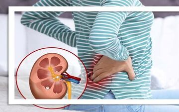 کلید پیشگیری از بیماری مزمن کلیه