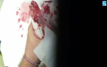 دختر 14 ساله زنده زنده خوراک موش ها شد! + تصاویر