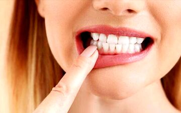لق شدن دندان‌ها زنگ خطر بیماری‌های جدی است؟


