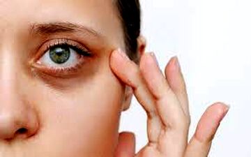  چرا دور چشم بعضی‌ها همیشه تیره است؟
