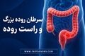 خون در مدفوع را نادیده نگیرید؛ سرطان روده چه علائمی دارد؟