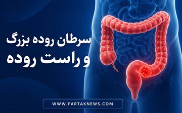 خون در مدفوع را نادیده نگیرید؛ سرطان روده چه علائمی دارد؟