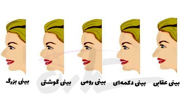  تست شخصیت شناسی از روی فرم بینی| رازهای شما برملا می شود!
