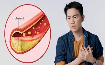 چگونه خشکبار به مدیریت کلسترول کمک میکند؟


