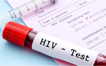  بیماران HIV اگر این نکات را بدانند سالم زندگی می کنند!