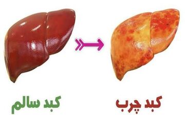 نوشیدنی‌های صبحگاهی برای کبد چرب