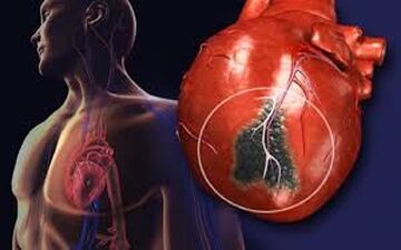 آیا بعداز حمله قلبی قلب دوباره میتواند مثل قبل شود؟