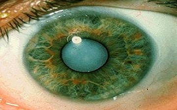 بیماری که عواقب خطرناکی دارد + فیلم