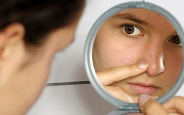چه موقع بخاطر جوش روی بینی به پزشک مراجعه کنیم؟