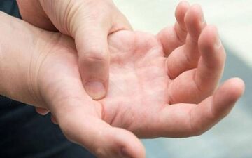 
آرتریت روماتوئید و نشانه های آن/ اینفوگرافیک