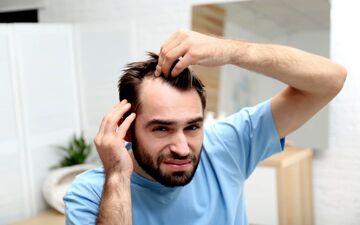 هشدار به کم‌خواب‌ها: کچلی، عاقبت بی‌خوابی‌های شما!