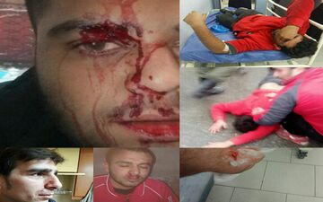 چاقوکشی خونین پس از دربی مازندران در لیگ دسته اول فوتبال + عکس