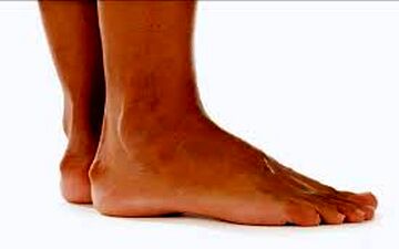 علت ایجاد خار پاشنه چیست؟