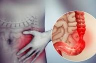 عوامل ایجاد سندروم روده تحریک پذیر