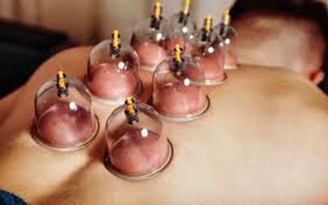 به هیچ عنوان در این مواقع حجامت نکنید!