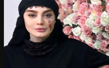 تتوی جدید سحر قریشی روی گردنش خبرساز شد!|تتلوی جدید در راه است!