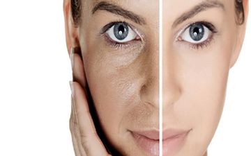 دمنوش های مناسب برای جوانسازی و شادابی پوست