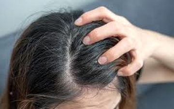 اگر از خارش پوست سر رنج میبرید حتما این مقاله را بخوانید!