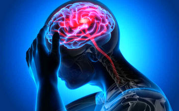 علائم سکته مغزی چیست؟