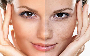 لک های پوستی را جدی بگیرید + فیلم