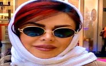  تغییرات ظاهری فلور نظری درپی جراحی های زیبایی عجیب