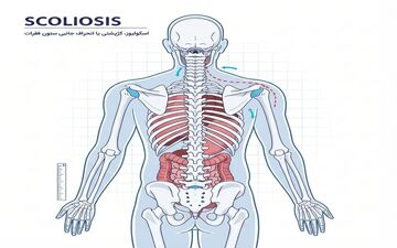 نقش دستگاه وزنه آزاد بدنسازی در اصلاح ناهنجاری‌های قامتی
