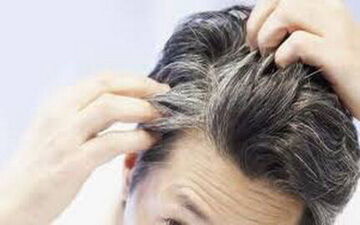 شناسایی ۶ مشکل سلامتی از ظاهر موی سر