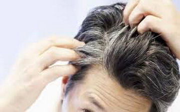 شناسایی ۶ مشکل سلامتی از ظاهر موی سر