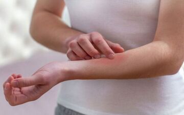 خارش پوست در نقاط مختلف بدن خبر از چه بیماری هایی می دهند؟ 