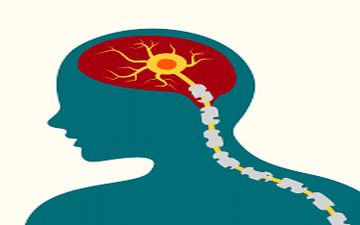 تغذیه در بیماران  MS بسیار مهم است!