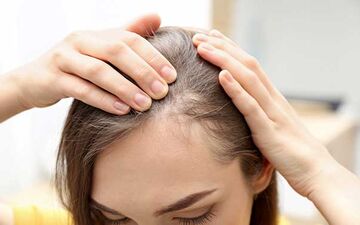  بایدها و نبایدهای مقابله با ریزش مو
