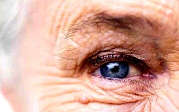 پیر چشمی چه علائمی دارد؟