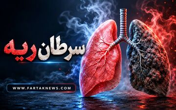 سرفه‌های مداوم را جدی بگیرید؛ سرطان ریه چه علائمی دارد؟