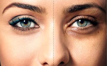 دور چشمهات سیاه میشه و نگرانی؟ با گلاب درست میشه این متن رو بخون
