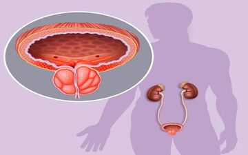 علائم اولیه سرطان پروستات !