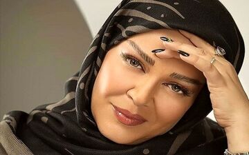 تغییر چهره باورنکردنی بهاره رهنما | بهاره دوباره عمل جراحی کرد + عکس باورنکردنی